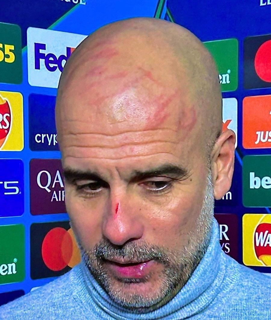Manchester City đã để thủng lưới ít nhất 2 bàn trong 6 trận liên tiếp, lần đầu tiên trong 61 năm gần đây của đội bóng