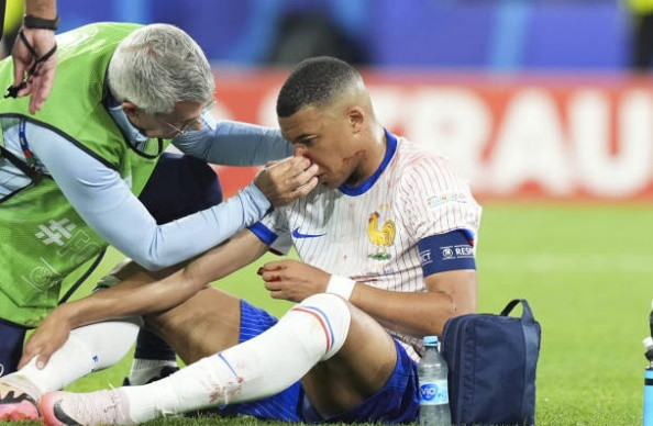 Deschamps tiết lộ giải pháp nếu thiếu Mbappe