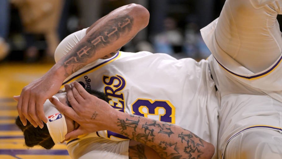 Anthony Davis' left eye is swollen and difficult to open