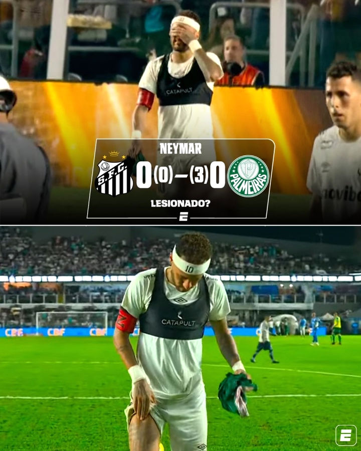 Lại chấn thương! Neymar dính chấn thương cơ thẳng đùi phải, Santos bị loại khỏi Cúp Brazil