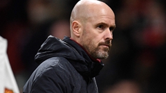 ฮือฮา “แมนยูฯ” ทำเซอร์ไพรส์ ก่อนบุกปะทะ “แมนฯ ซิตี้” ศึกแมนเชสเตอร์ดาร์บี